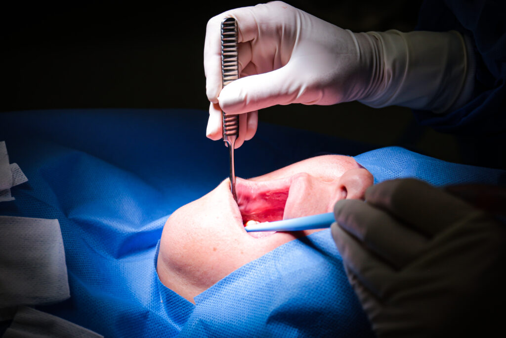 Hospital de Chile Chico fortalece atención en implantología y reduce lista de espera